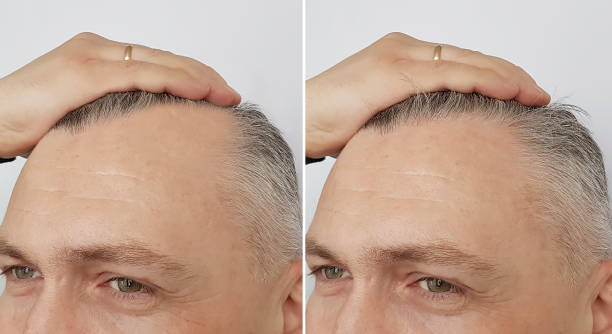 HAIR GROWTH SERUM 1 oz